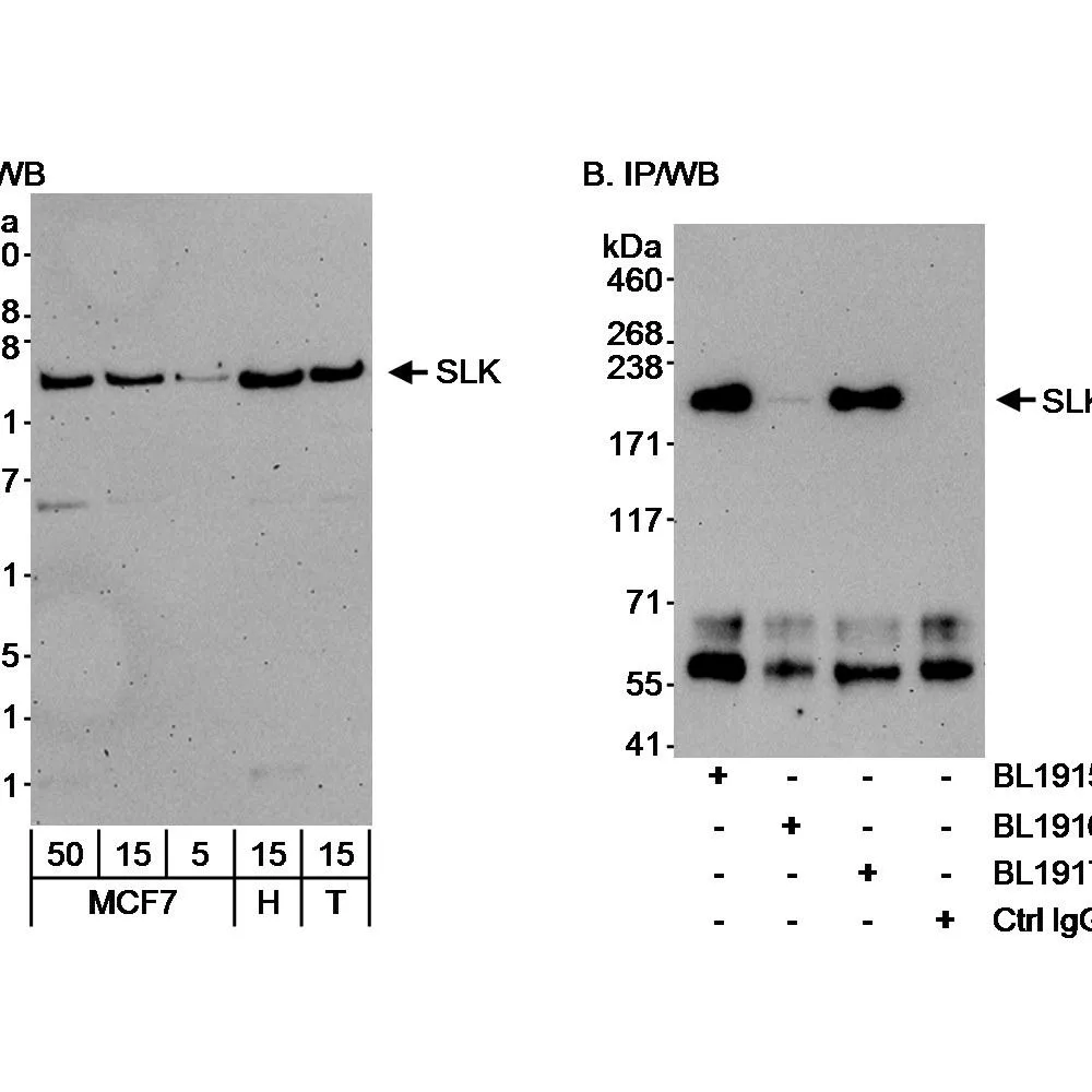Rabbit anti-SLK Antibody, Affinity Purified