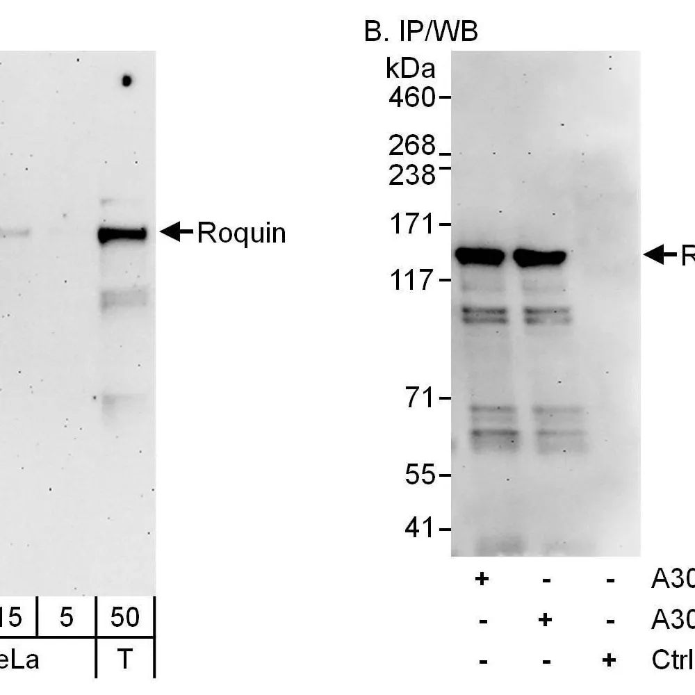 Rabbit anti-Roquin Antibody, Affinity Purified