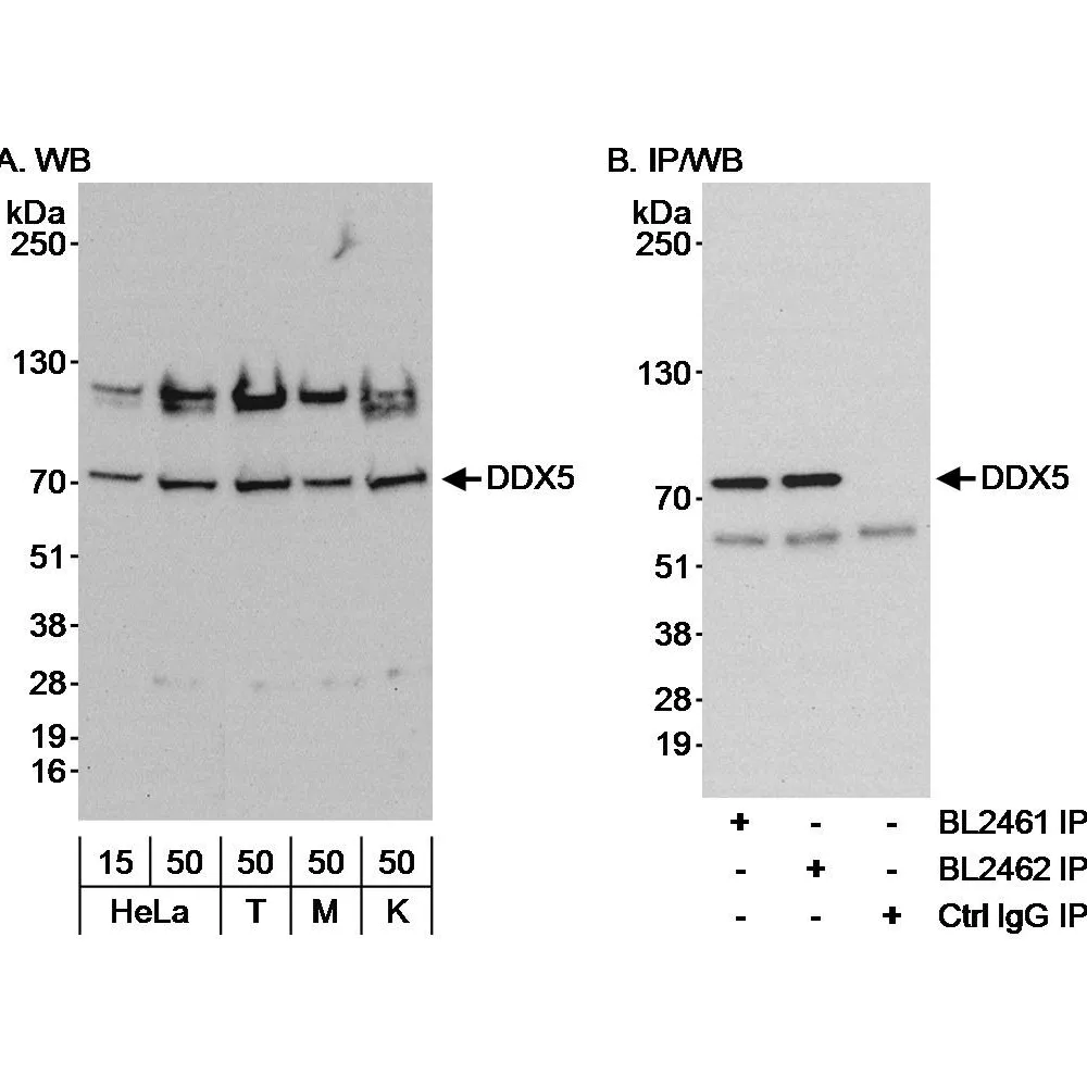 Rabbit anti-DDX5 Antibody, Affinity Purified