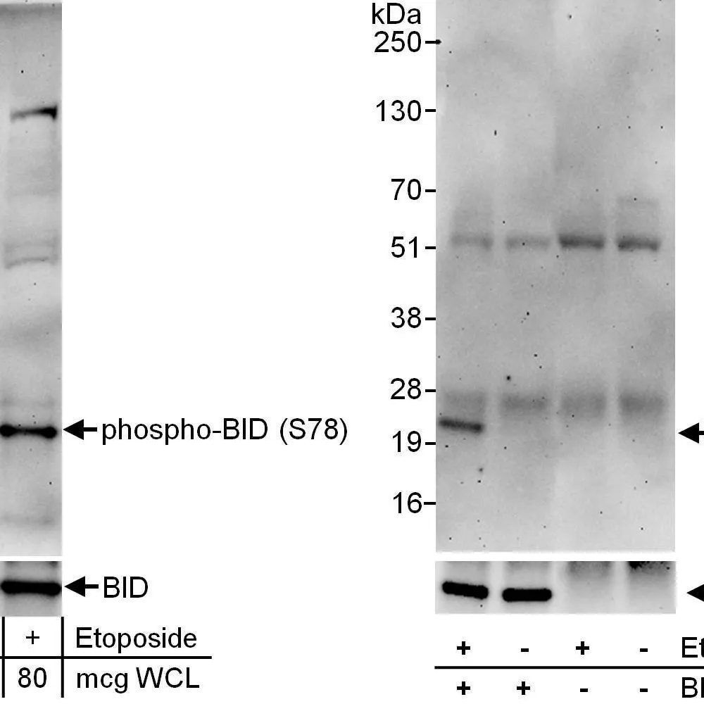Rabbit anti-Phospho BID (S78) Antibody, Affinity Purified