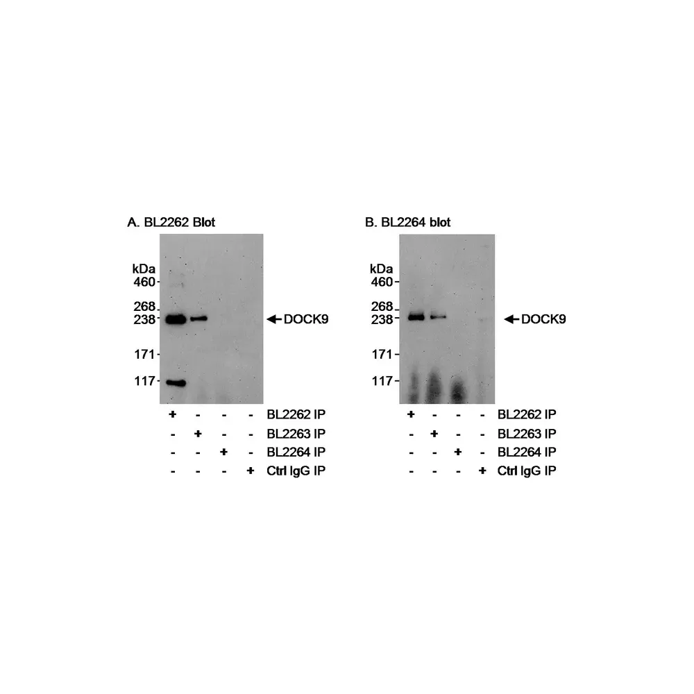 Rabbit anti-DOCK9 Antibody, Affinity Purified