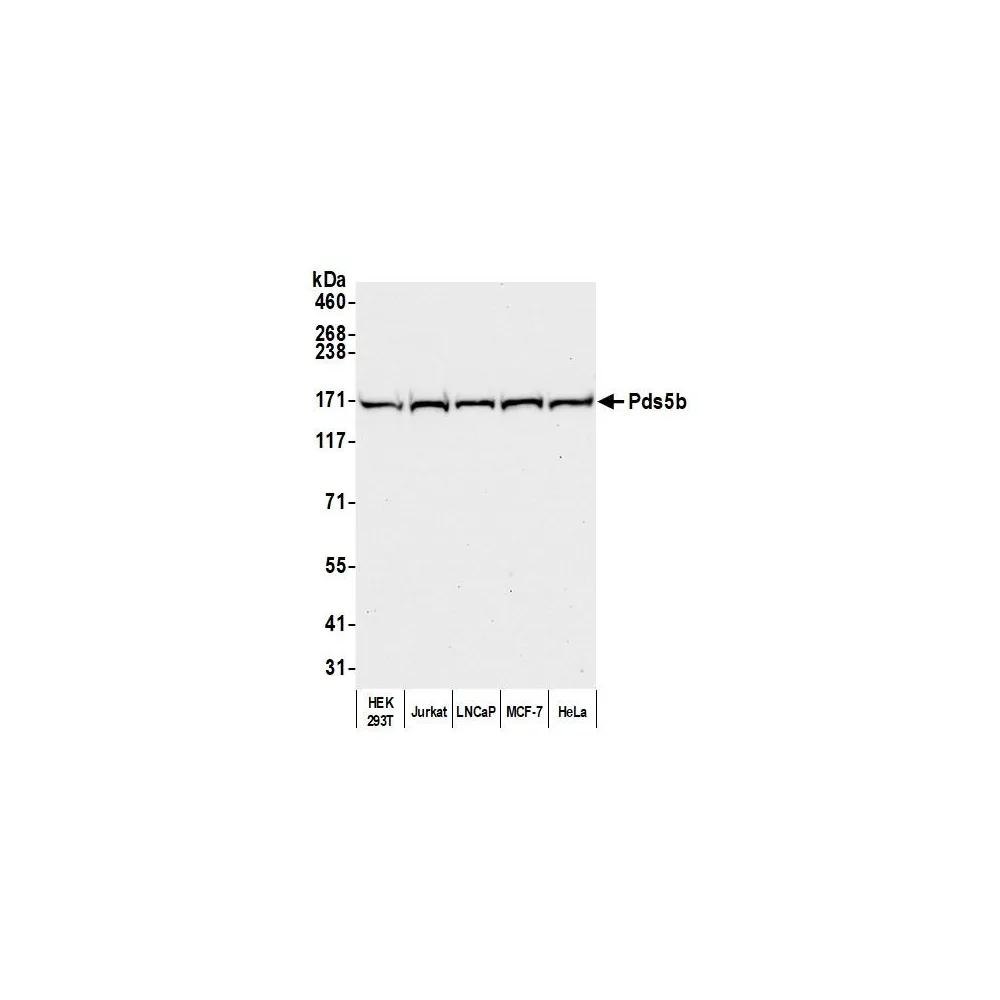 Rabbit anti-Pds5B Antibody, Affinity Purified