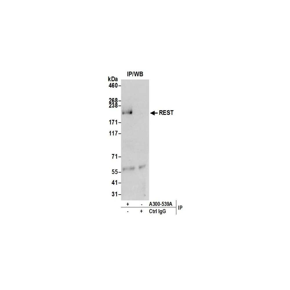 Rabbit anti-REST Antibody, Affinity Purified