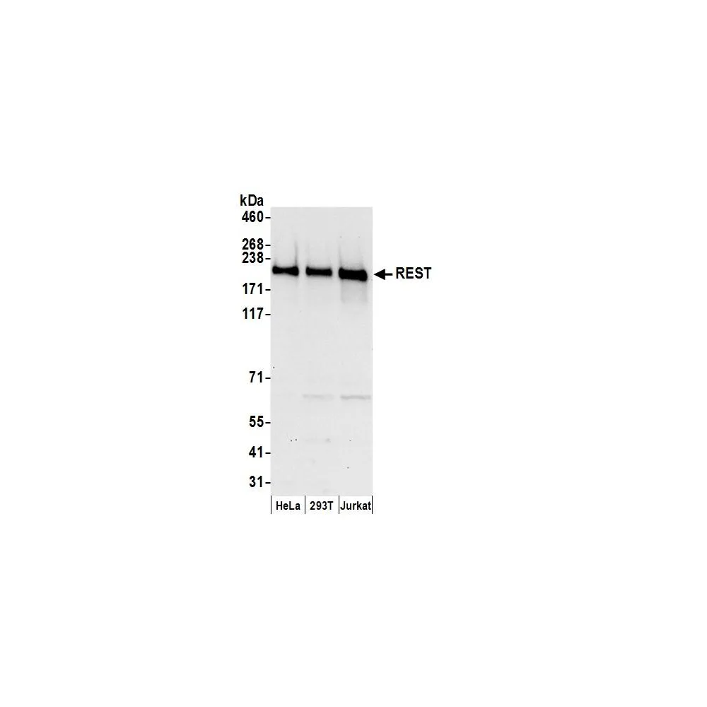 Rabbit anti-REST Antibody, Affinity Purified