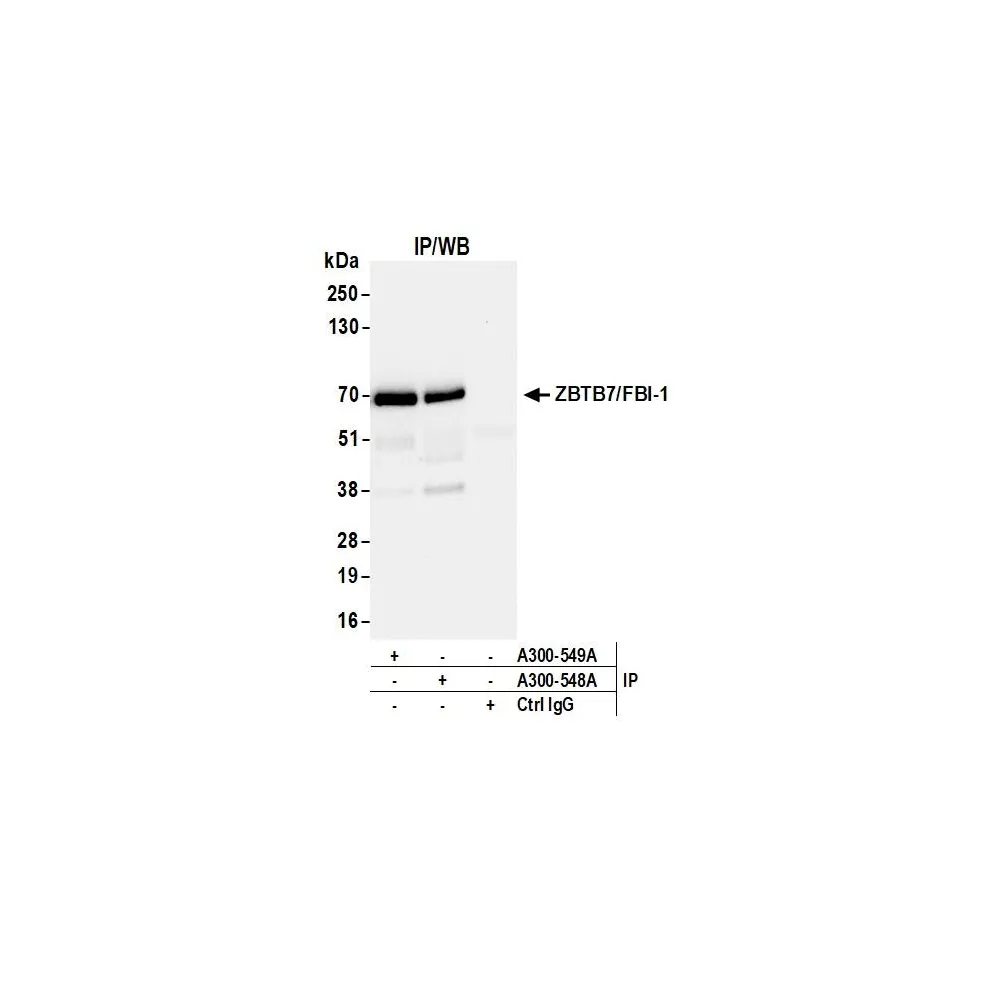 Rabbit anti-ZBTB7/FBI-1 Antibody, Affinity Purified