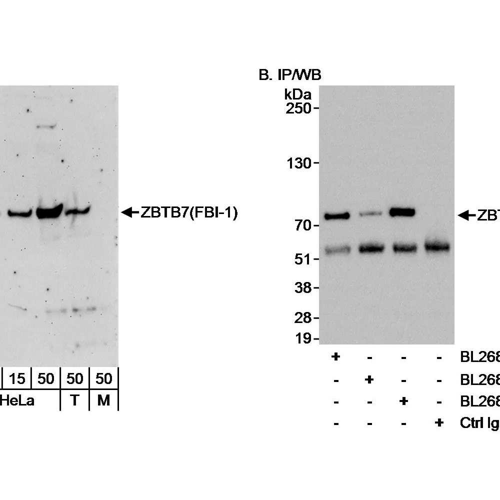 Rabbit anti-ZBTB7/FBI-1 Antibody, Affinity Purified