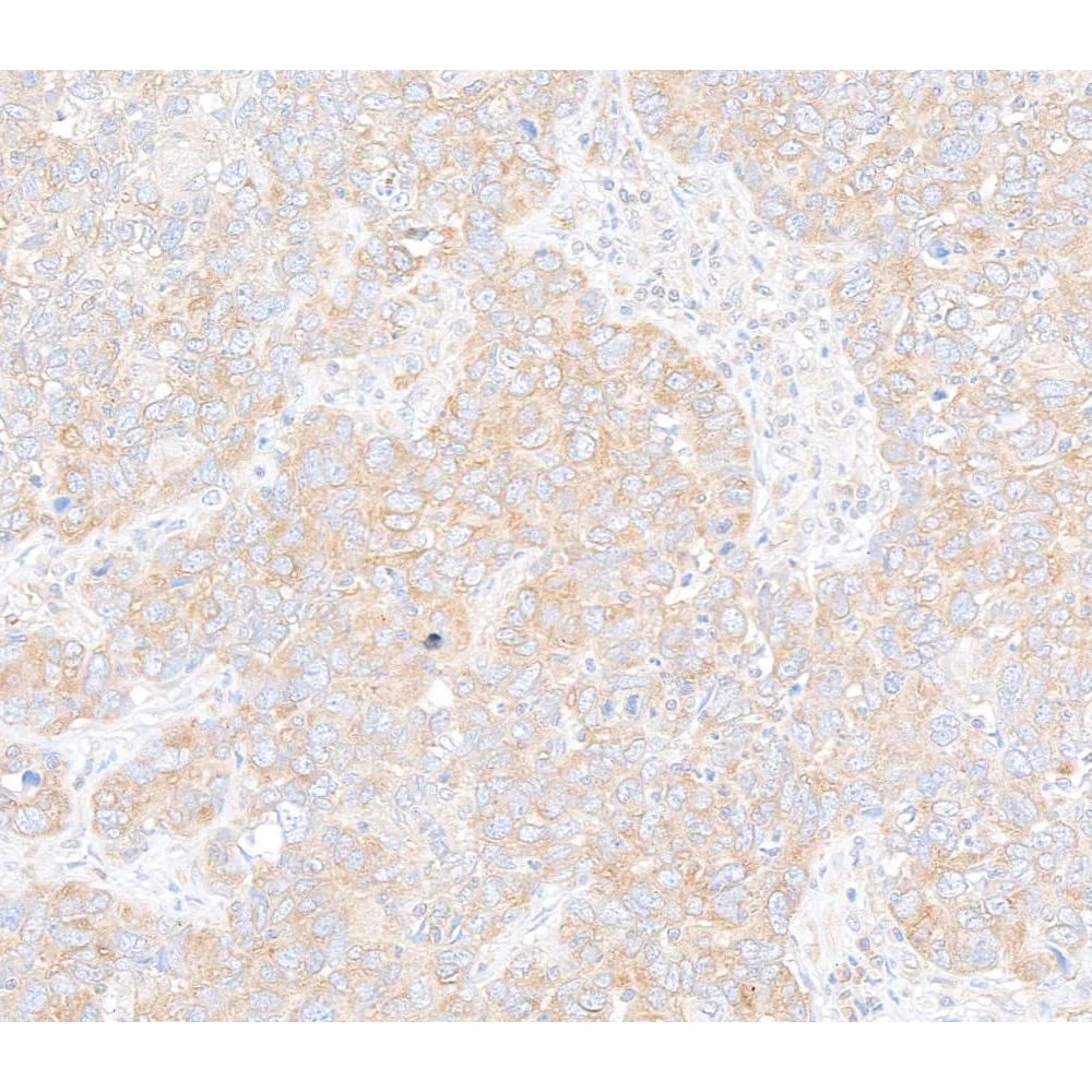 Rabbit anti-RPS6 Antibody, Affinity Purified