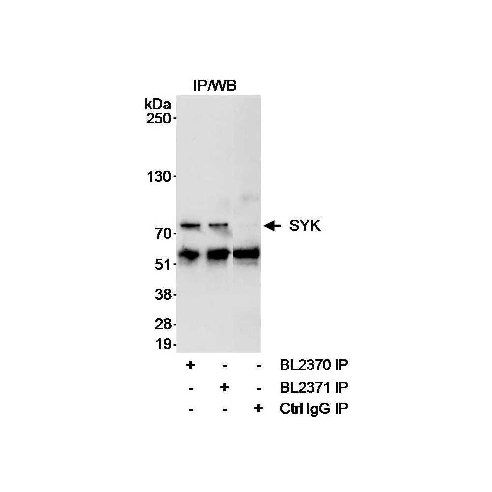 Rabbit anti-SYK Antibody, Affinity Purified