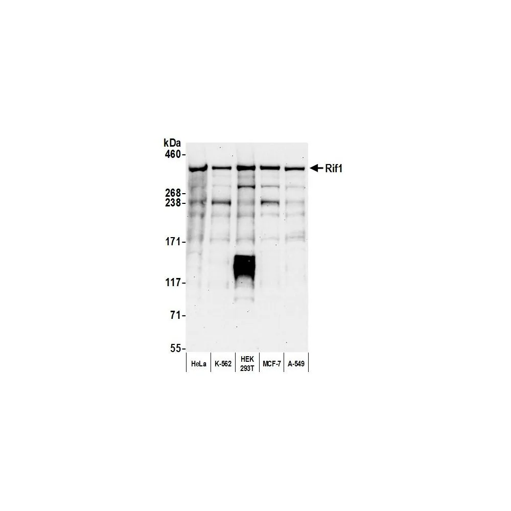 Rabbit anti-RIF1 Antibody, Affinity Purified