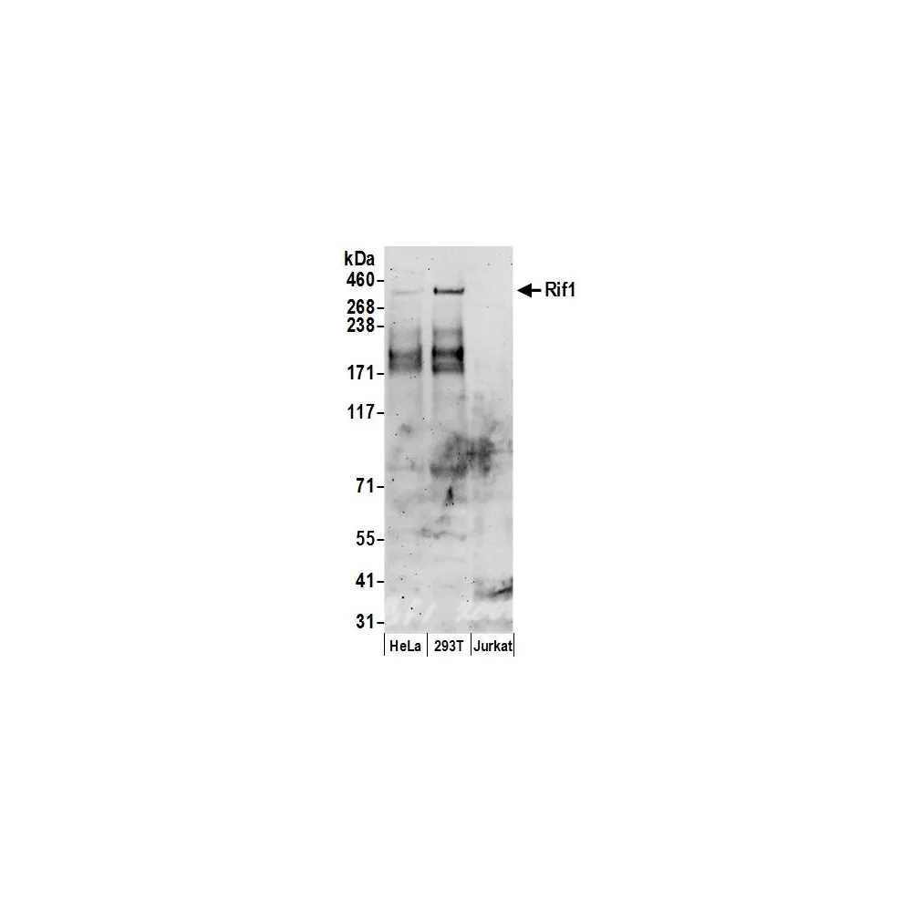 Rabbit anti-RIF1 Antibody, Affinity Purified