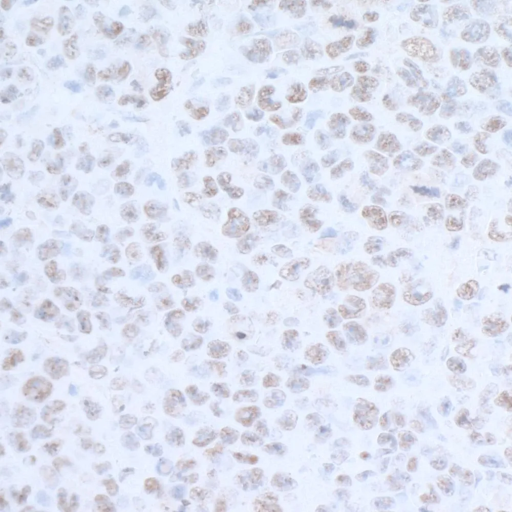 Rabbit anti-EDD1 Antibody, Affinity Purified