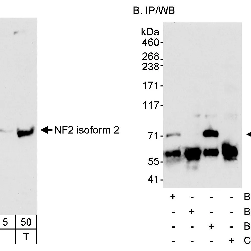 Rabbit anti-NF2 Antibody, Affinity Purified