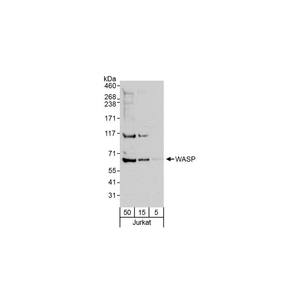 Rabbit anti-WASP Antibody, Affinity Purified