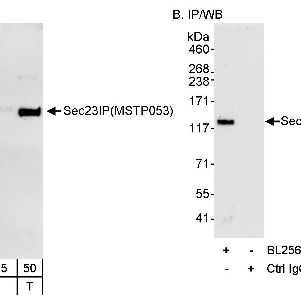 Rabbit anti-Sec23IP/MSTP053 Antibody, Affinity Purified