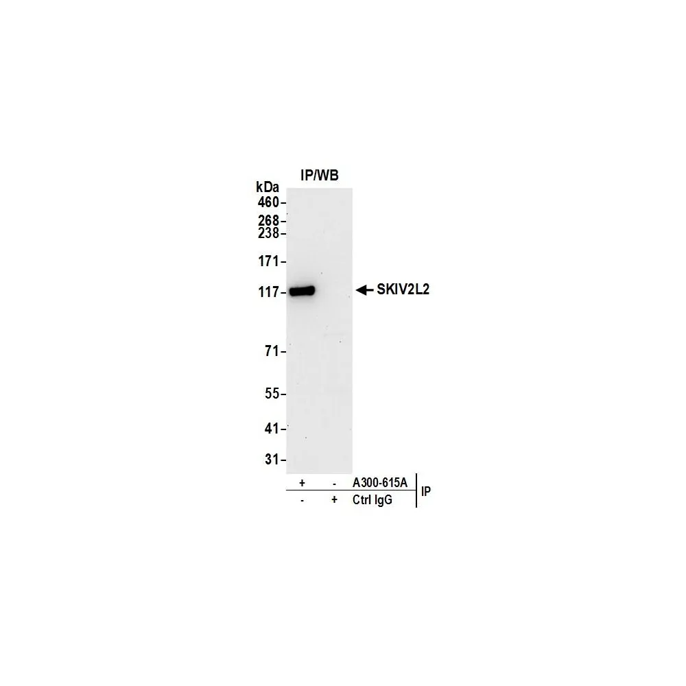 Rabbit anti-SKIV2L2 Antibody, Affinity Purified