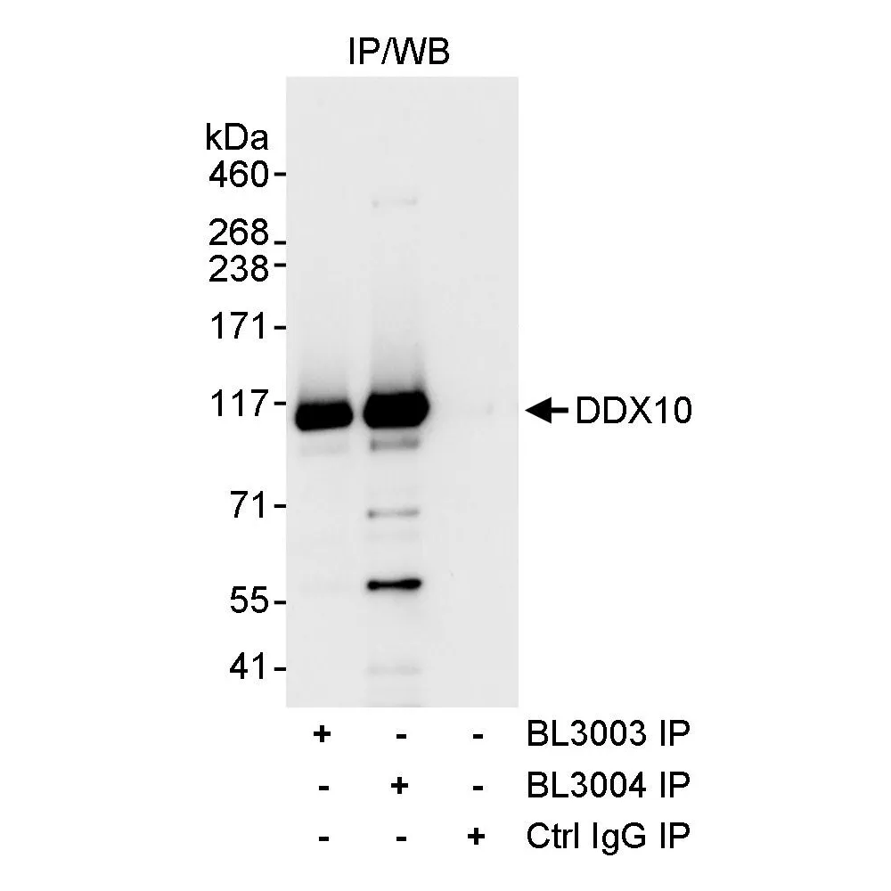 Rabbit anti-DDX10 Antibody, Affinity Purified