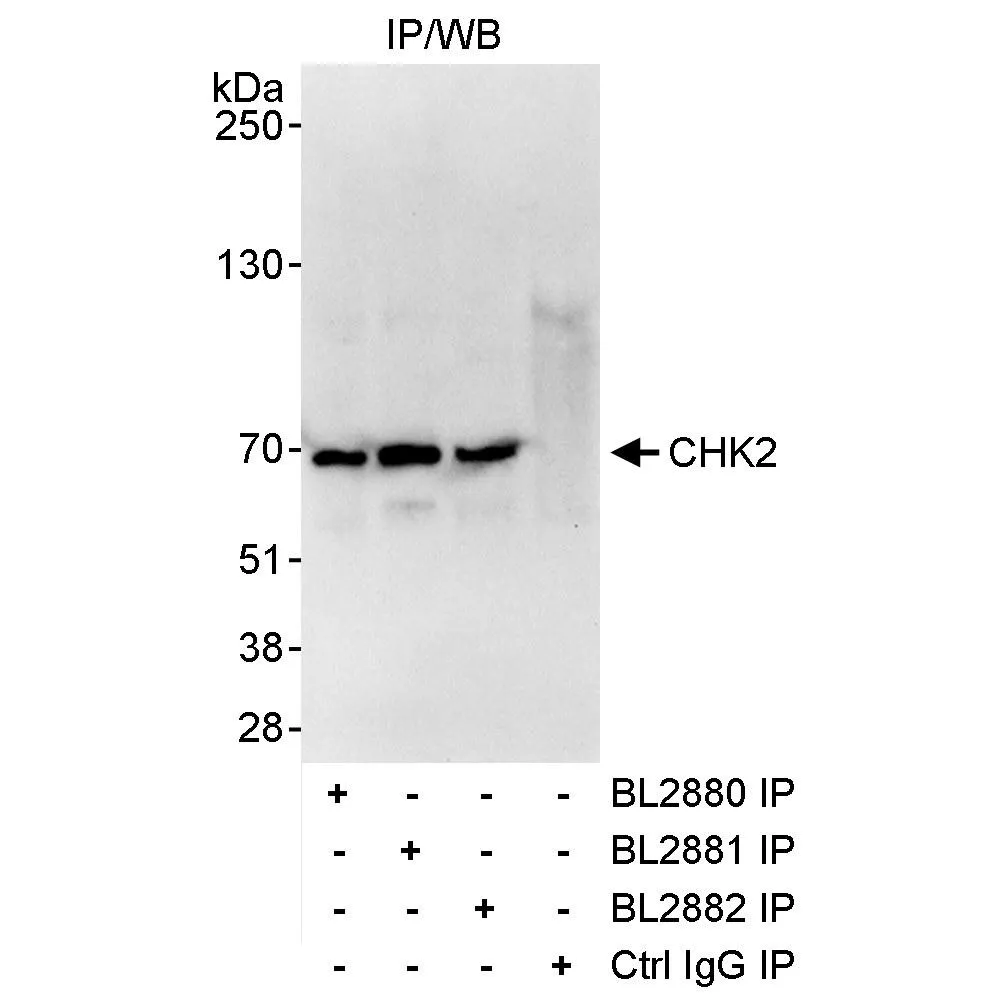 Rabbit anti-Chk2 Antibody, Affinity Purified