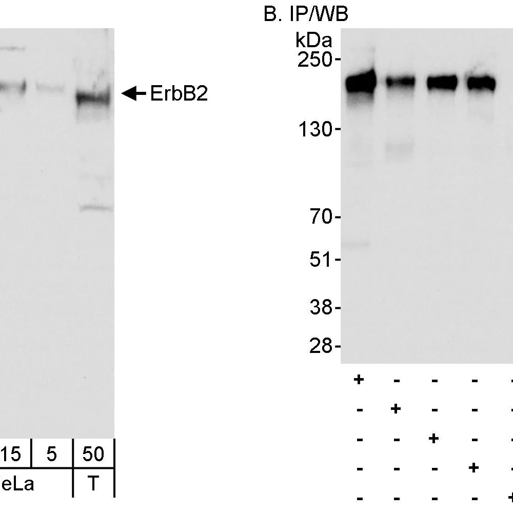 Rabbit anti-ErbB2 Antibody, Affinity Purified