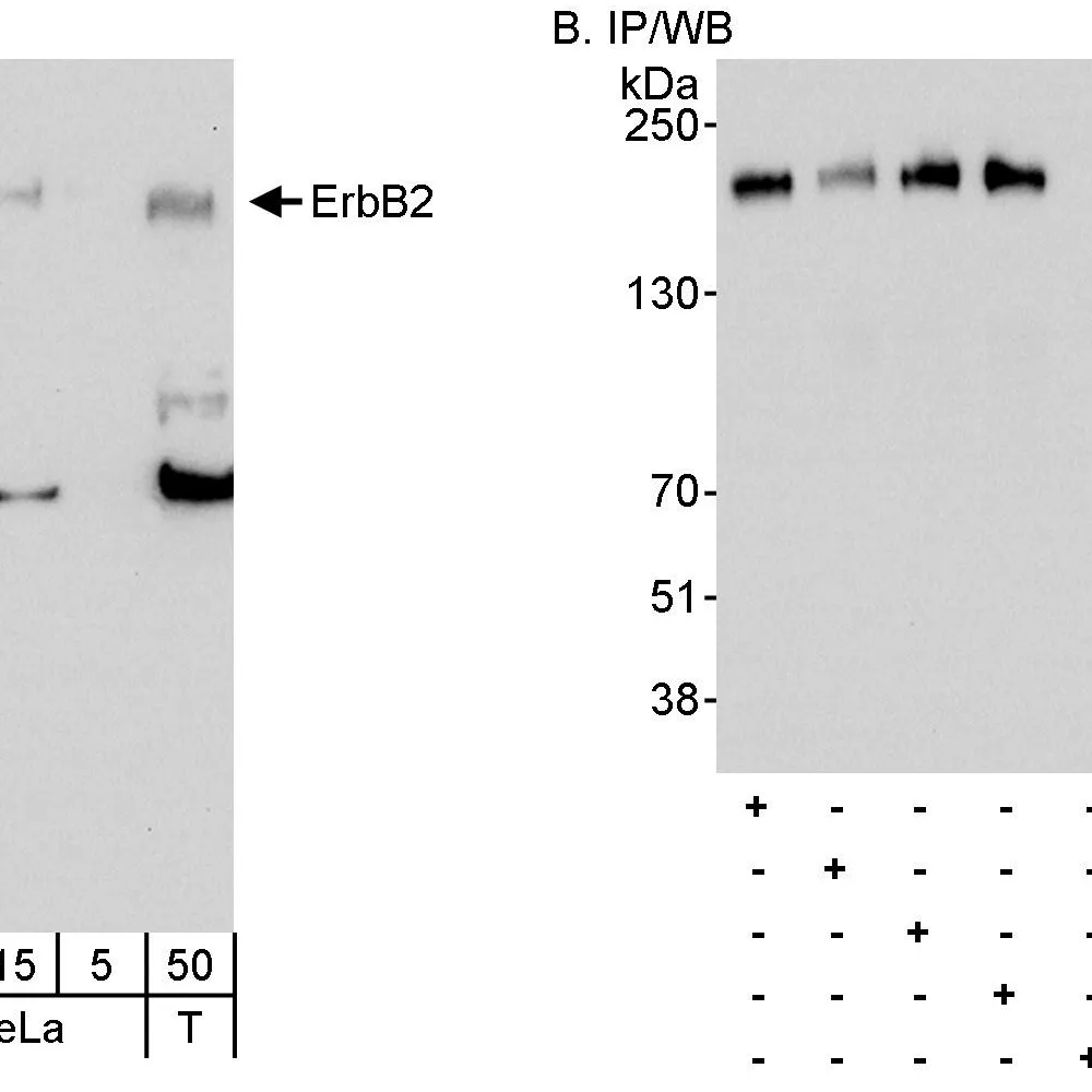 Rabbit anti-ErbB2 Antibody, Affinity Purified