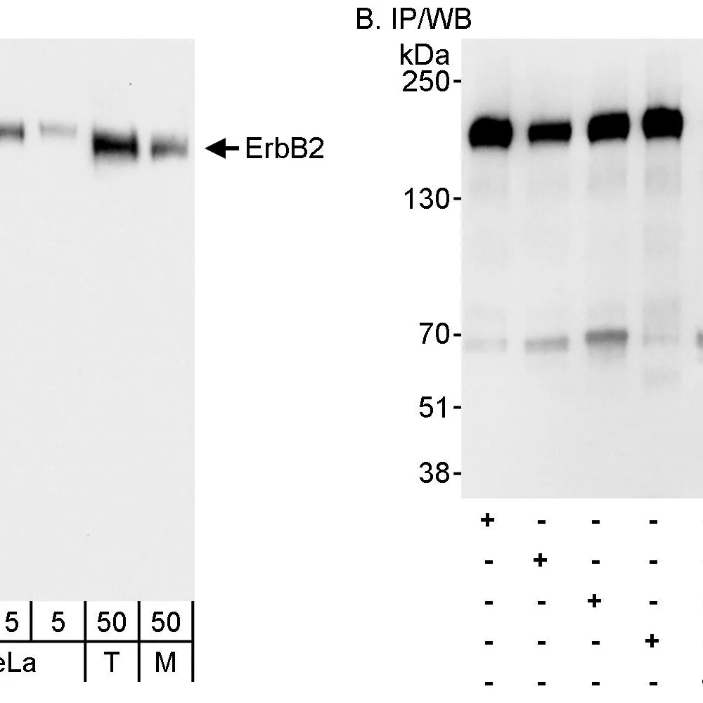 Rabbit anti-ErbB2 Antibody, Affinity Purified