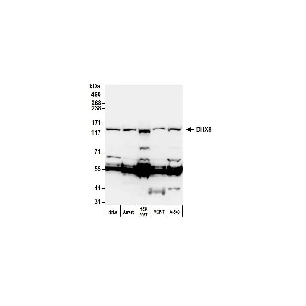 Rabbit anti-DHX8 Antibody, Affinity Purified