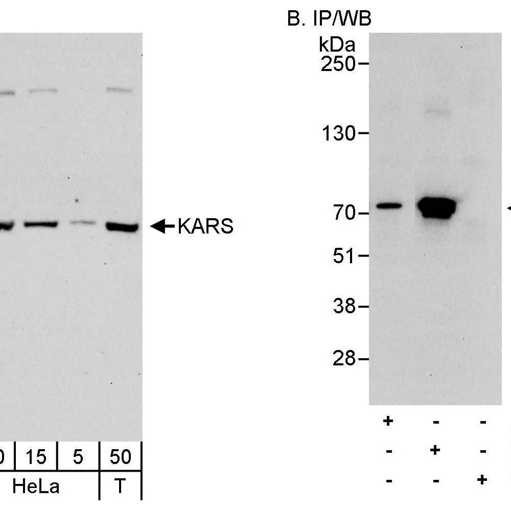 Rabbit anti-KARS Antibody, Affinity Purified