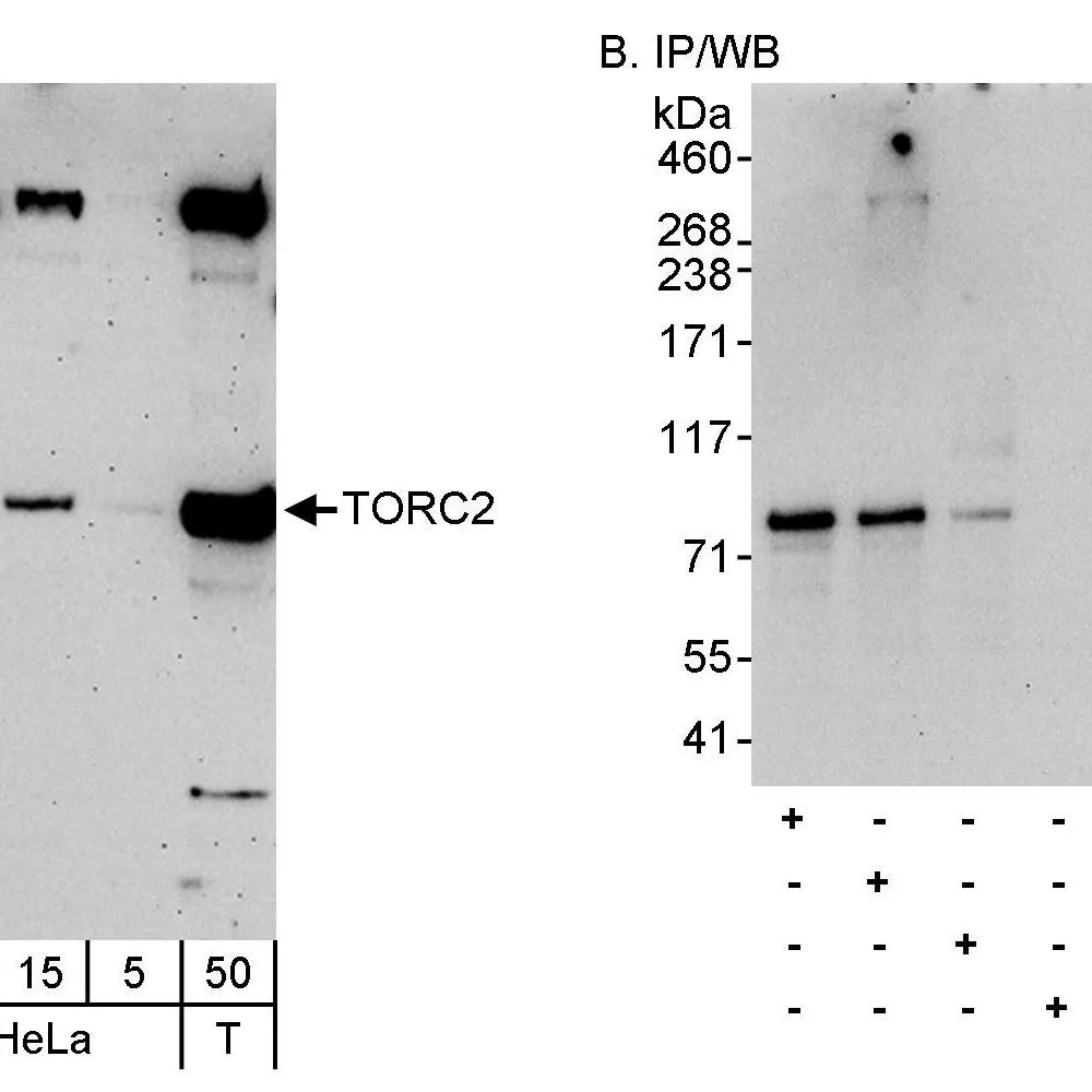 Rabbit anti-TORC2 Antibody, Affinity Purified