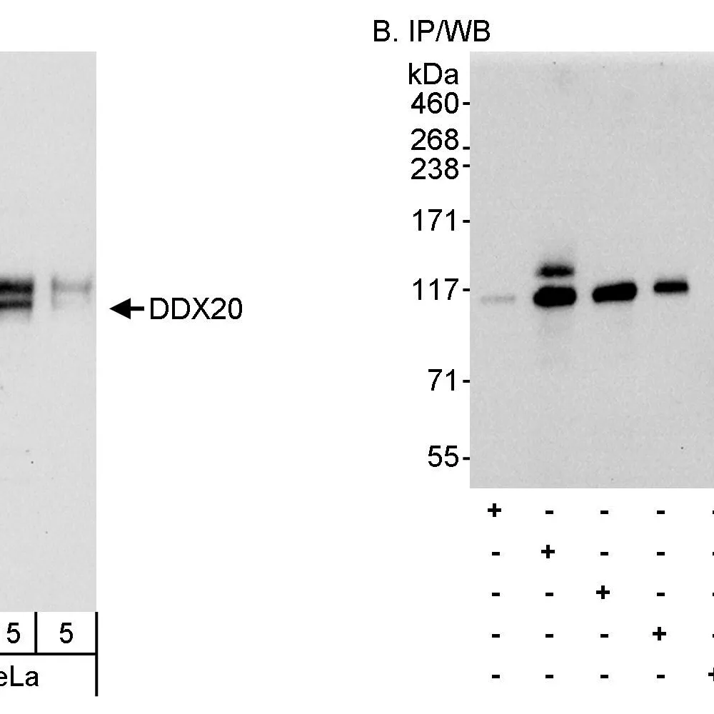Rabbit anti-DDX20 Antibody, Affinity Purified