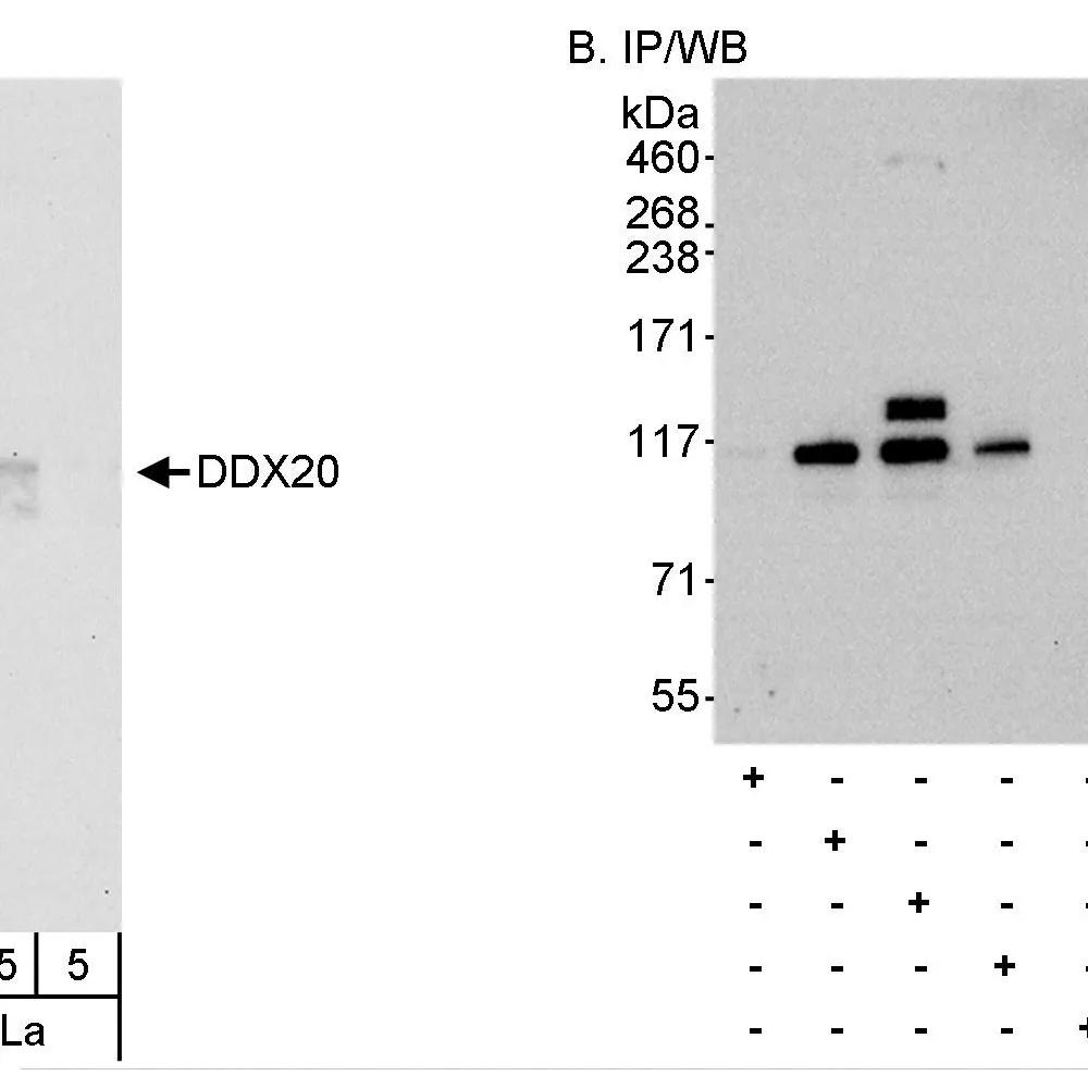 Rabbit anti-DDX20 Antibody, Affinity Purified