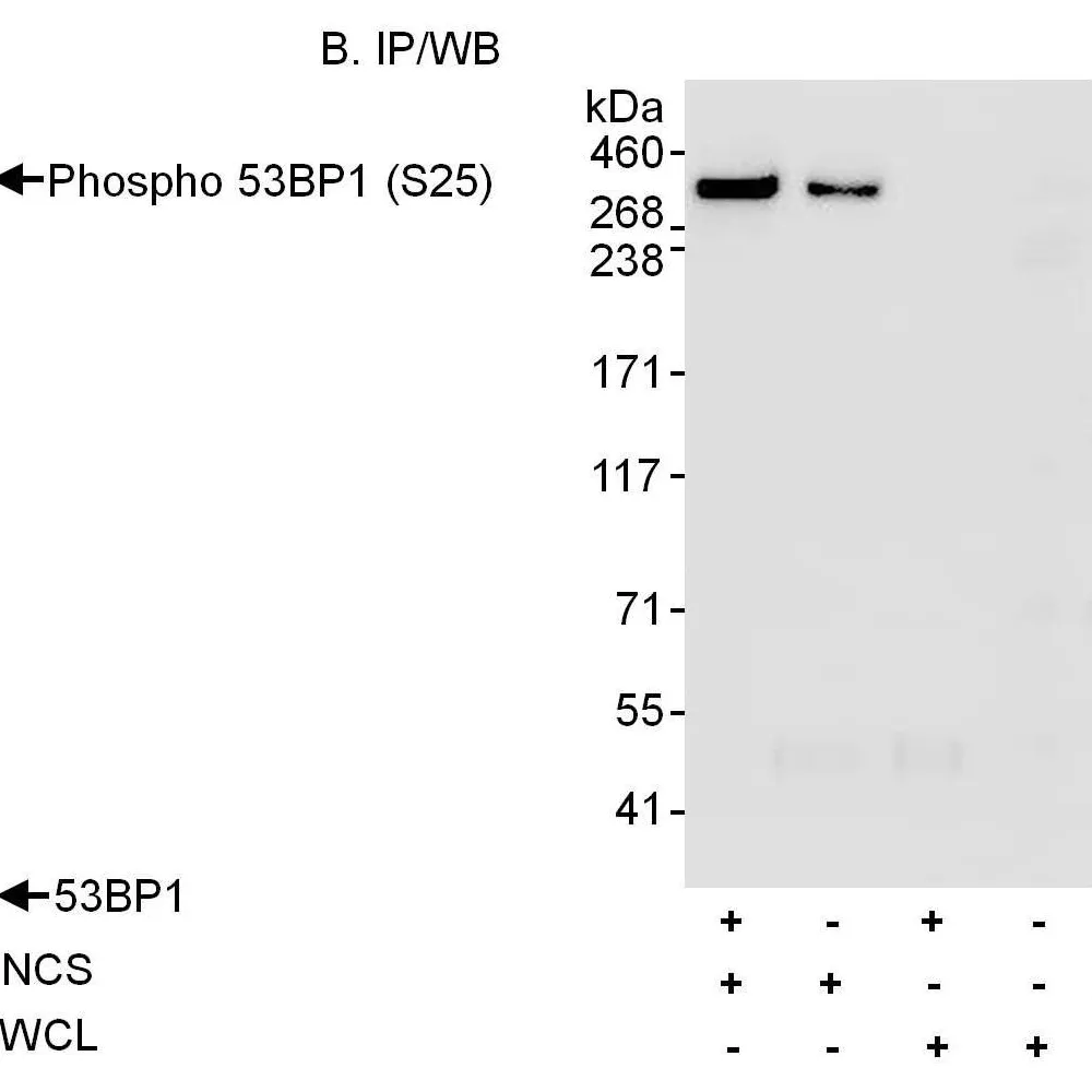 Rabbit anti-Phospho 53BP1 (S25) Antibody, Affinity Purified