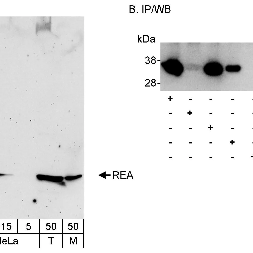 Rabbit anti-REA Antibody, Affinity Purified