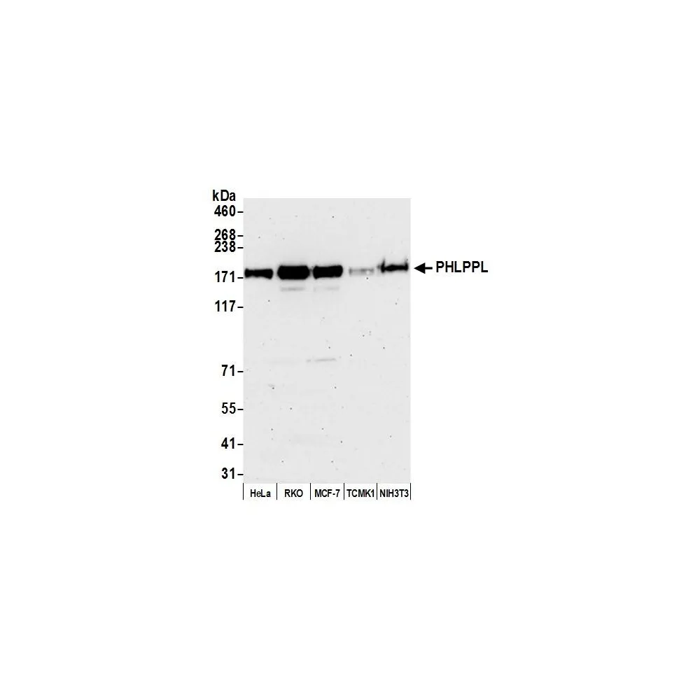 Rabbit anti-PHLPPL Antibody, Affinity Purified