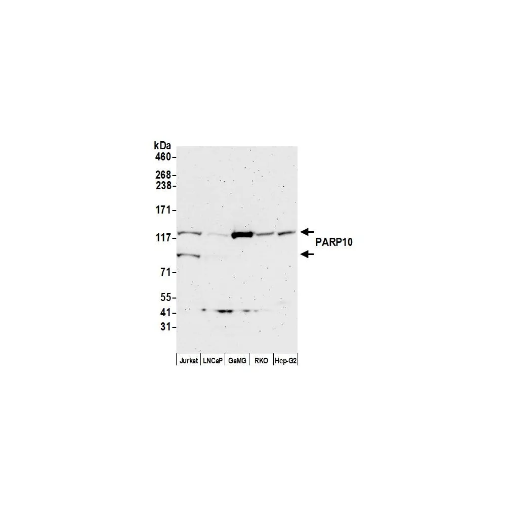 Rabbit anti-PARP10 Antibody, Affinity Purified