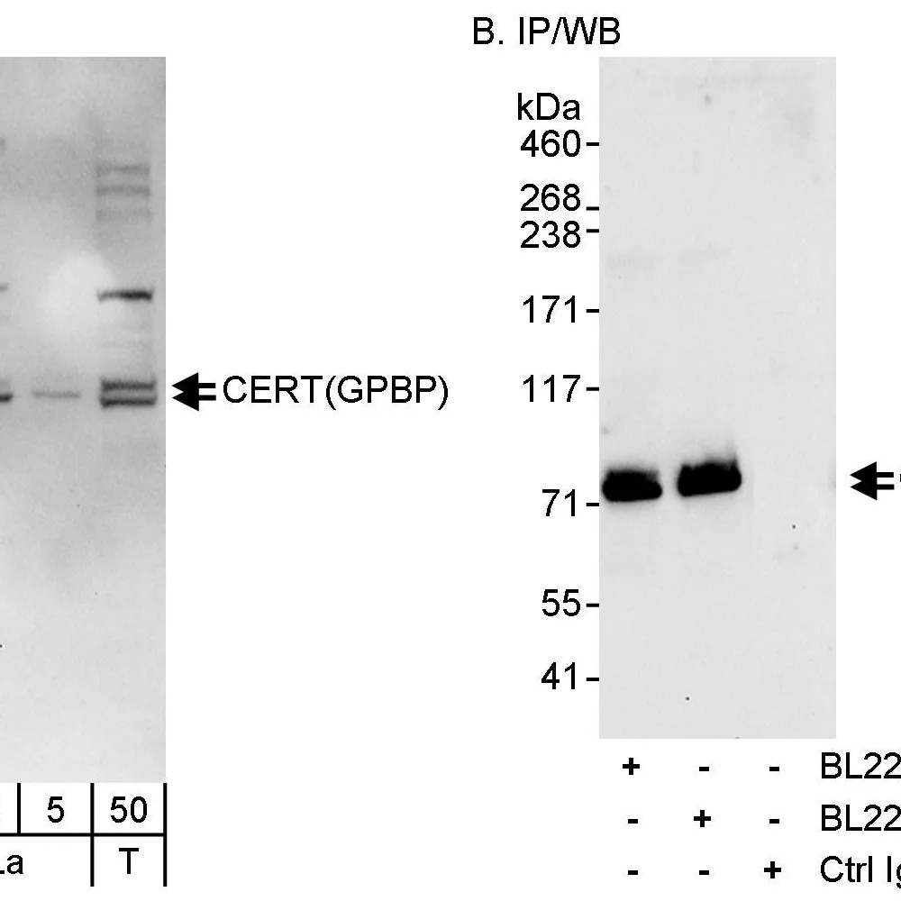 Rabbit anti-CERT/GPBP Antibody, Affinity Purified