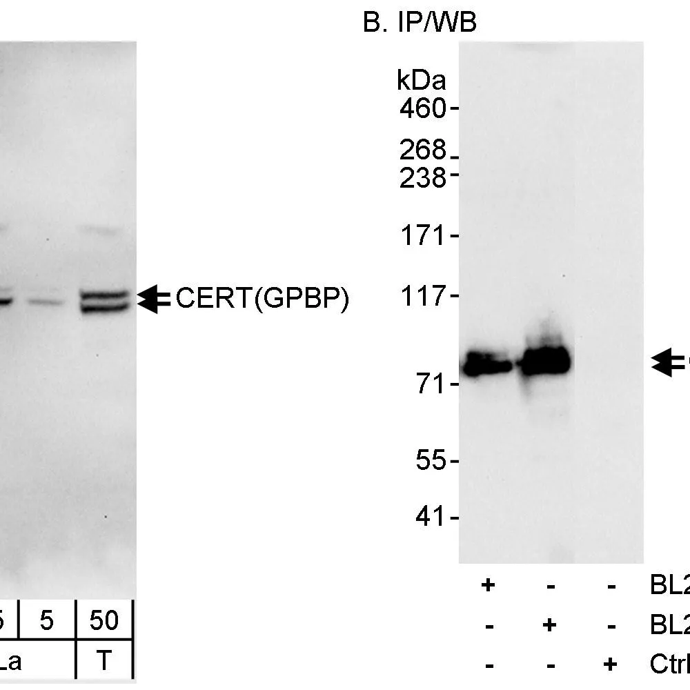 Rabbit anti-CERT/GPBP Antibody, Affinity Purified