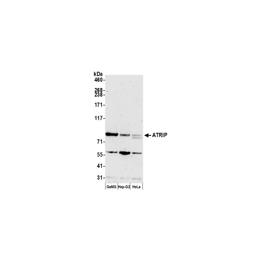 Rabbit anti-ATRIP Antibody, Affinity Purified