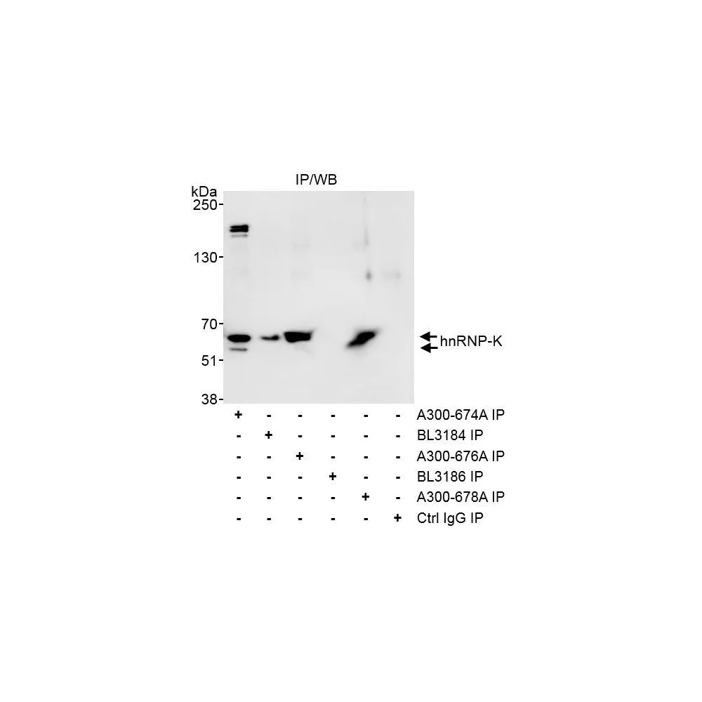 Rabbit anti-hnRNP-K Antibody, Affinity Purified
