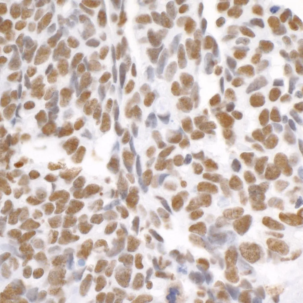 Rabbit anti-hnRNP-K Antibody, Affinity Purified