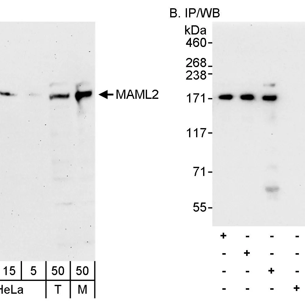 Rabbit anti-MAML2 Antibody, Affinity Purified