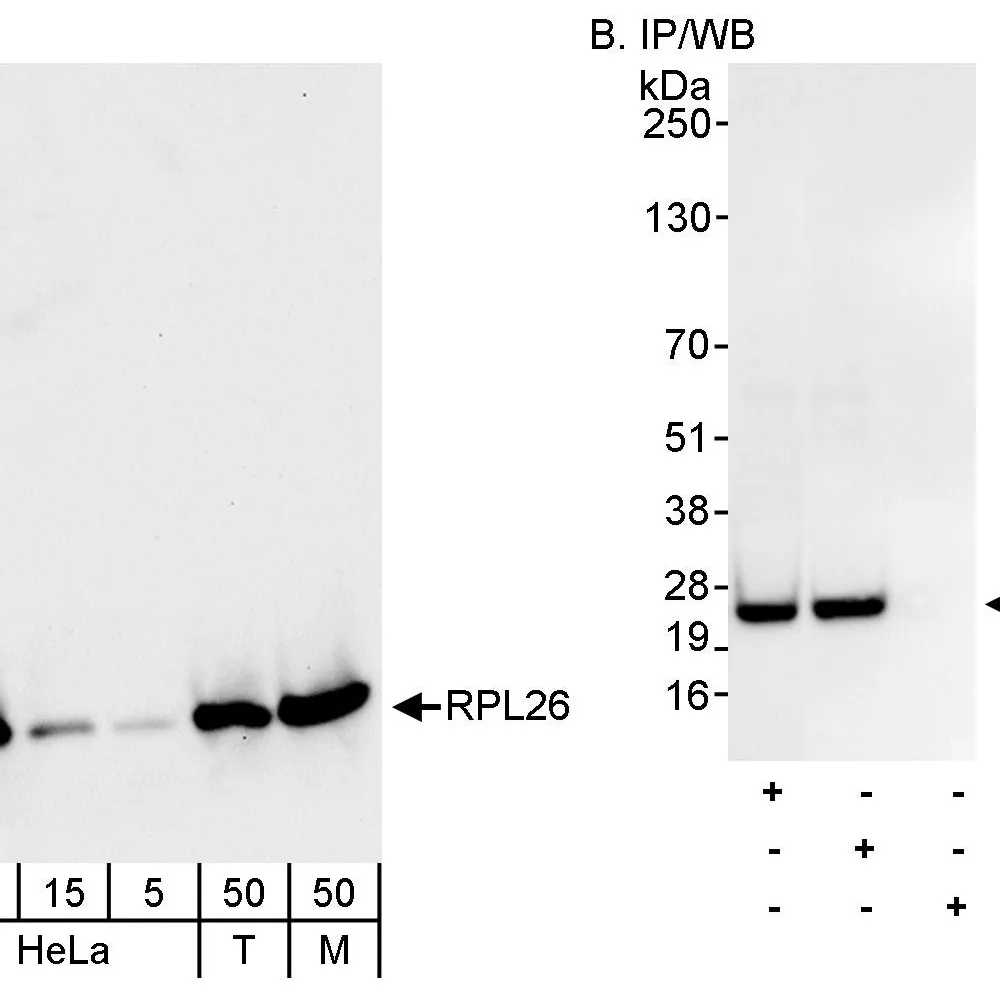 Rabbit anti-RPL26 Antibody, Affinity Purified