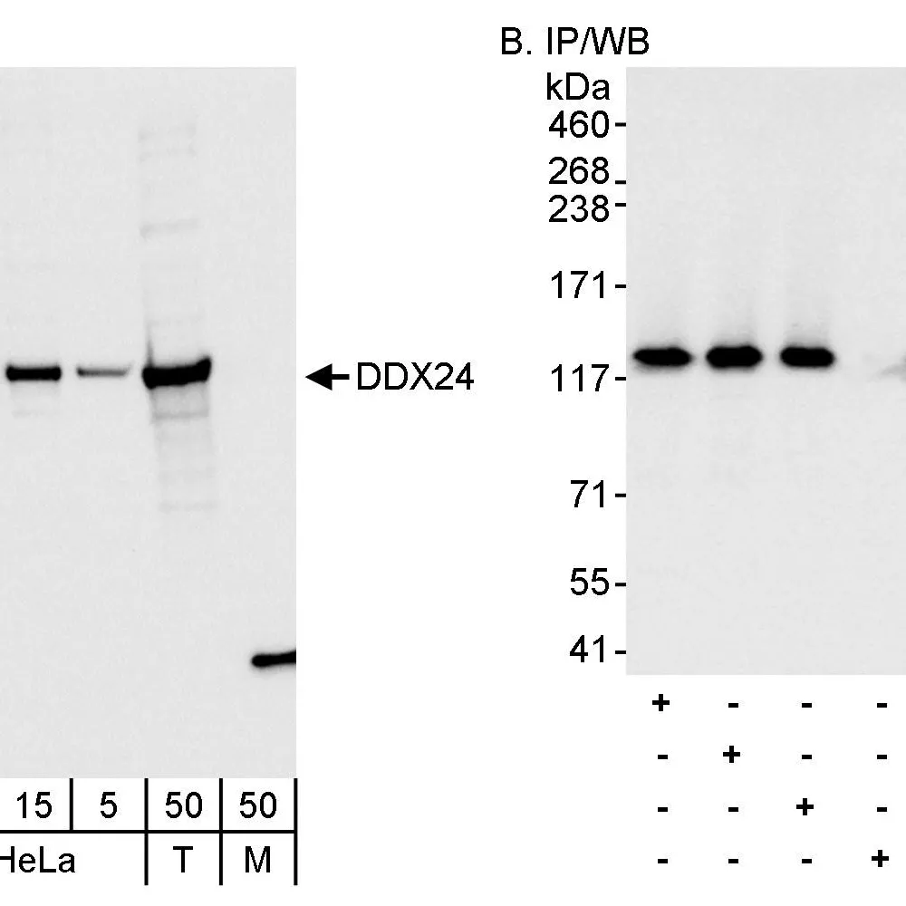 Rabbit anti-DDX24 Antibody, Affinity Purified