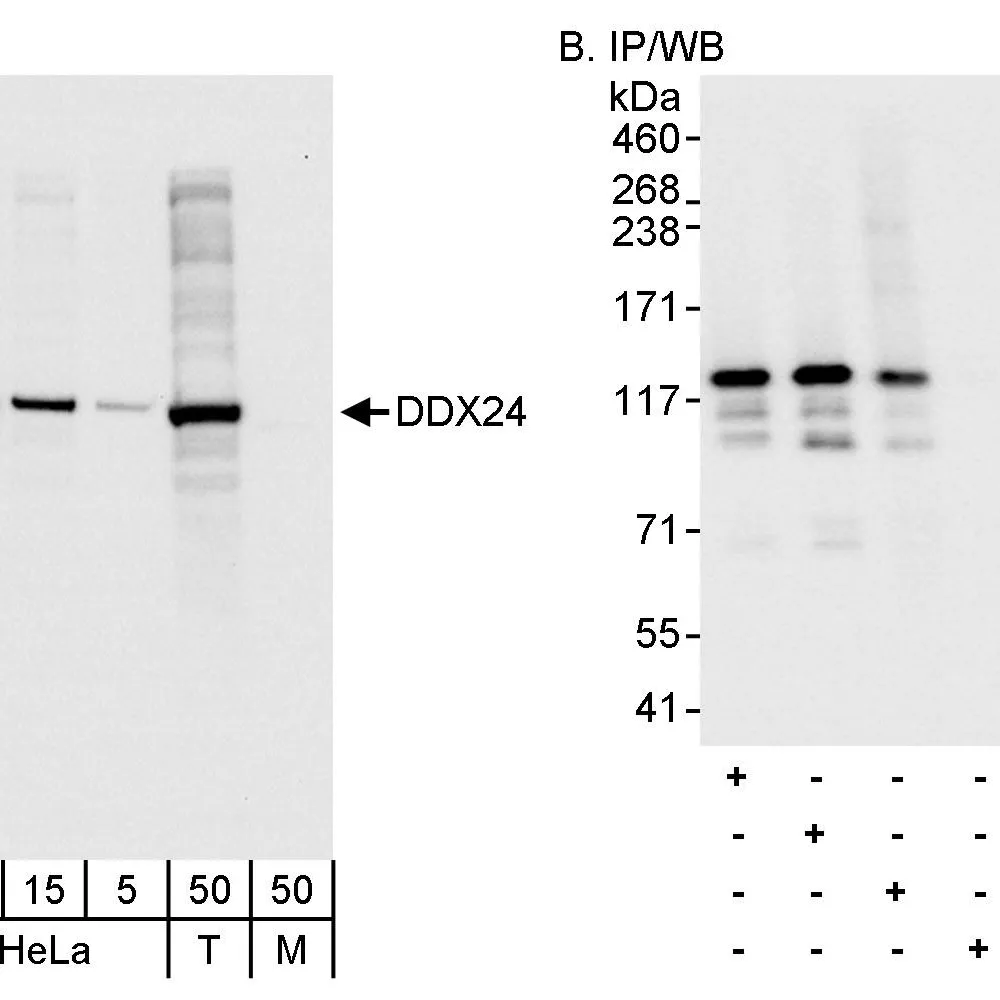 Rabbit anti-DDX24 Antibody, Affinity Purified