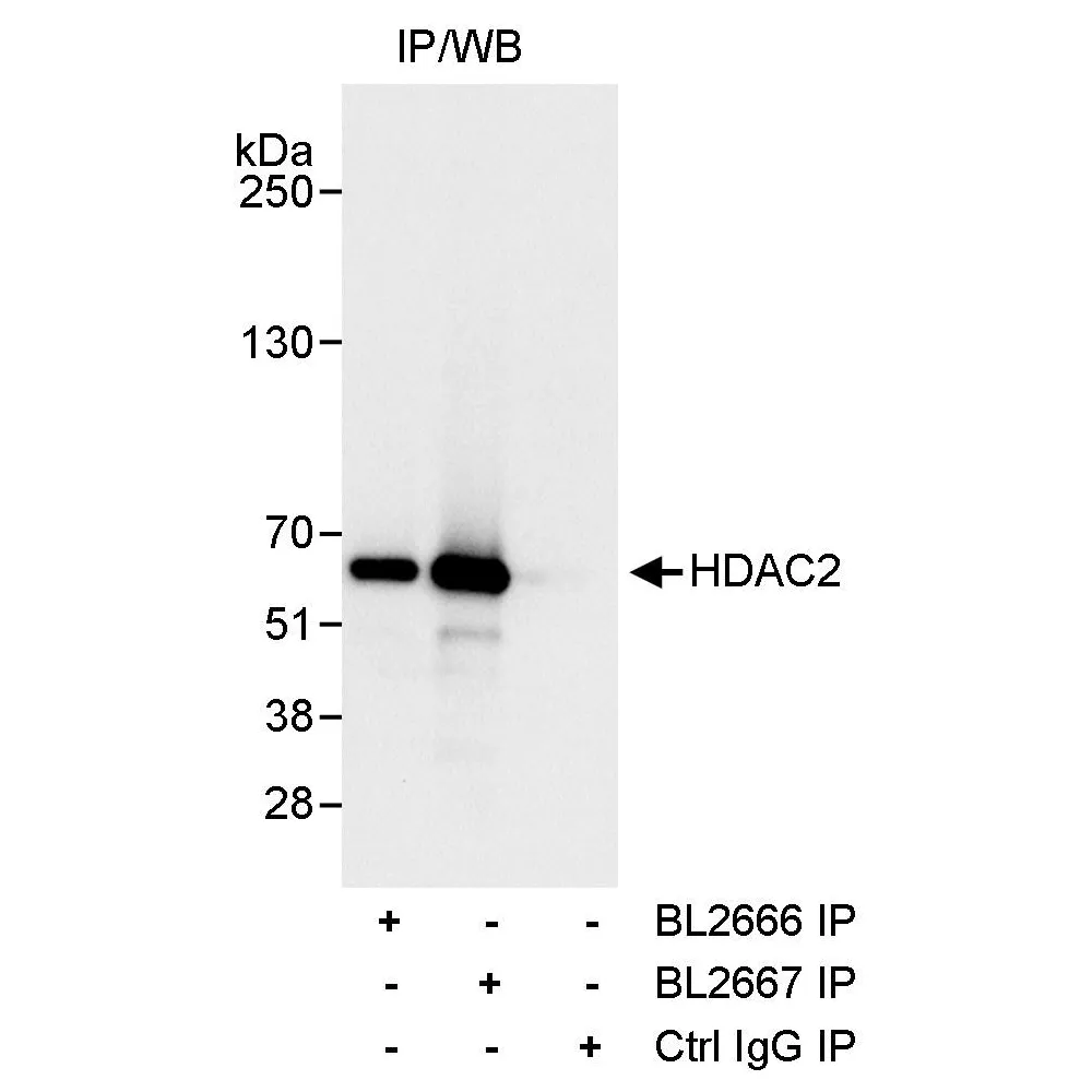Rabbit anti-HDAC2 Antibody, Affinity Purified
