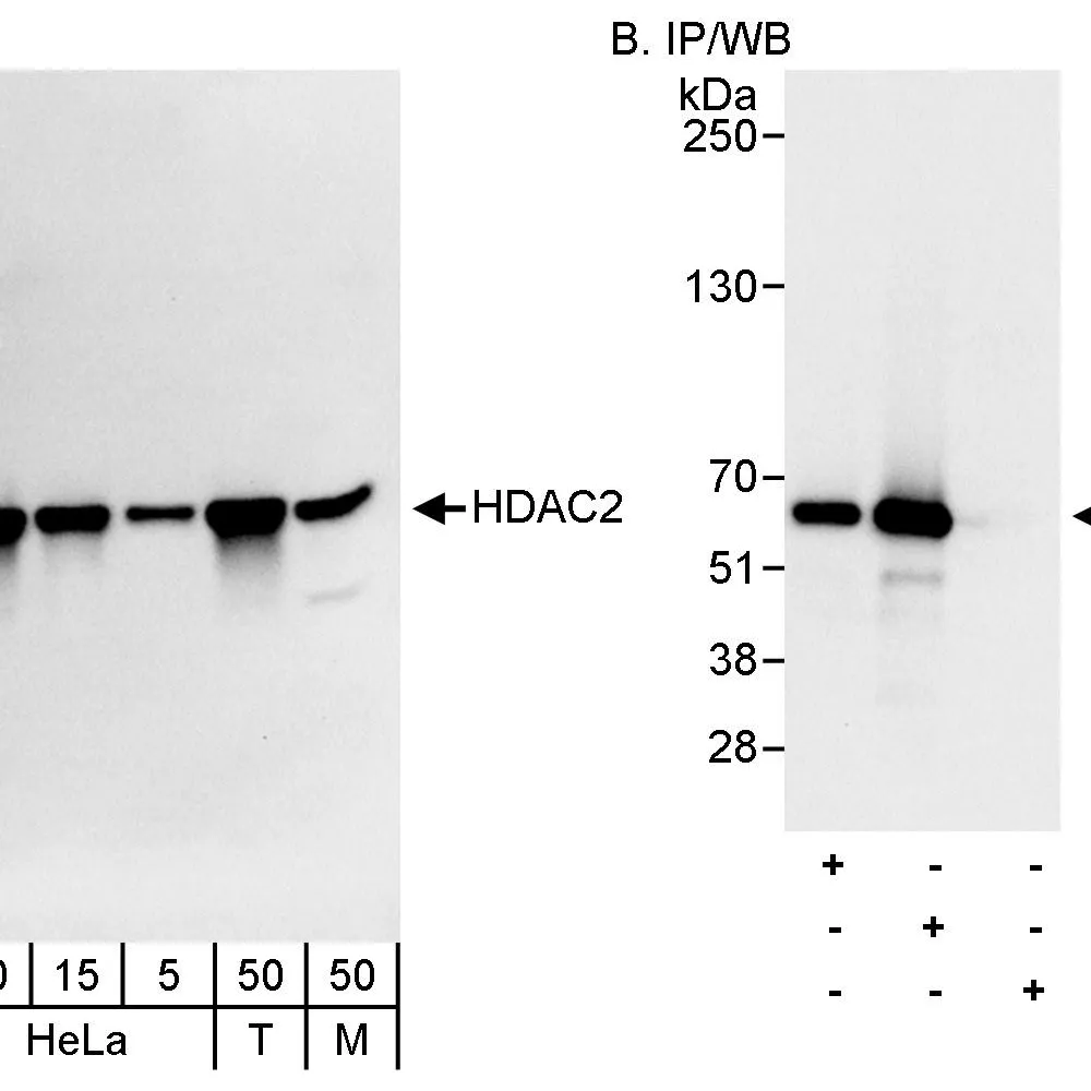 Rabbit anti-HDAC2 Antibody, Affinity Purified