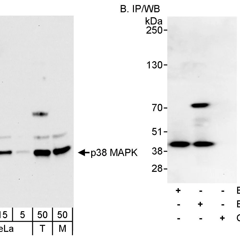 Rabbit anti-p38 MAPK Antibody, Affinity Purified