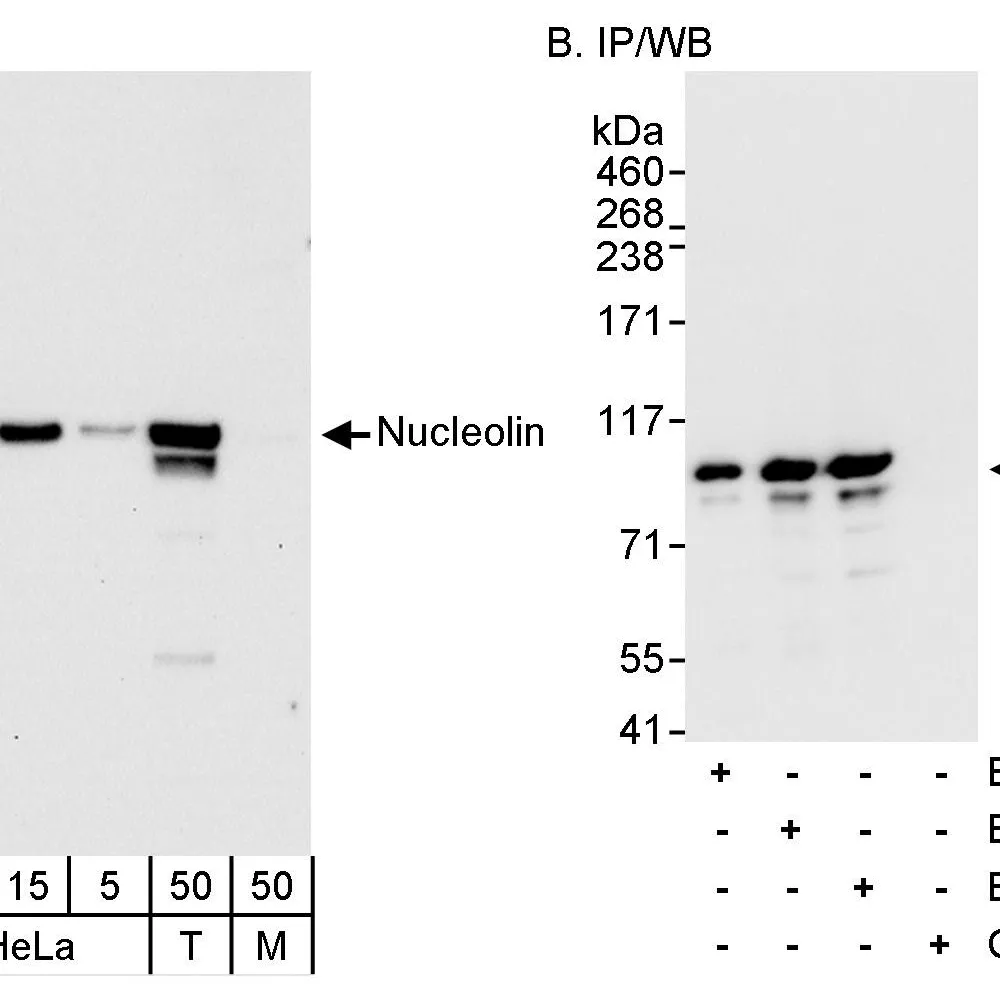 Rabbit anti-Nucleolin (NCL) Antibody, Affinity Purified