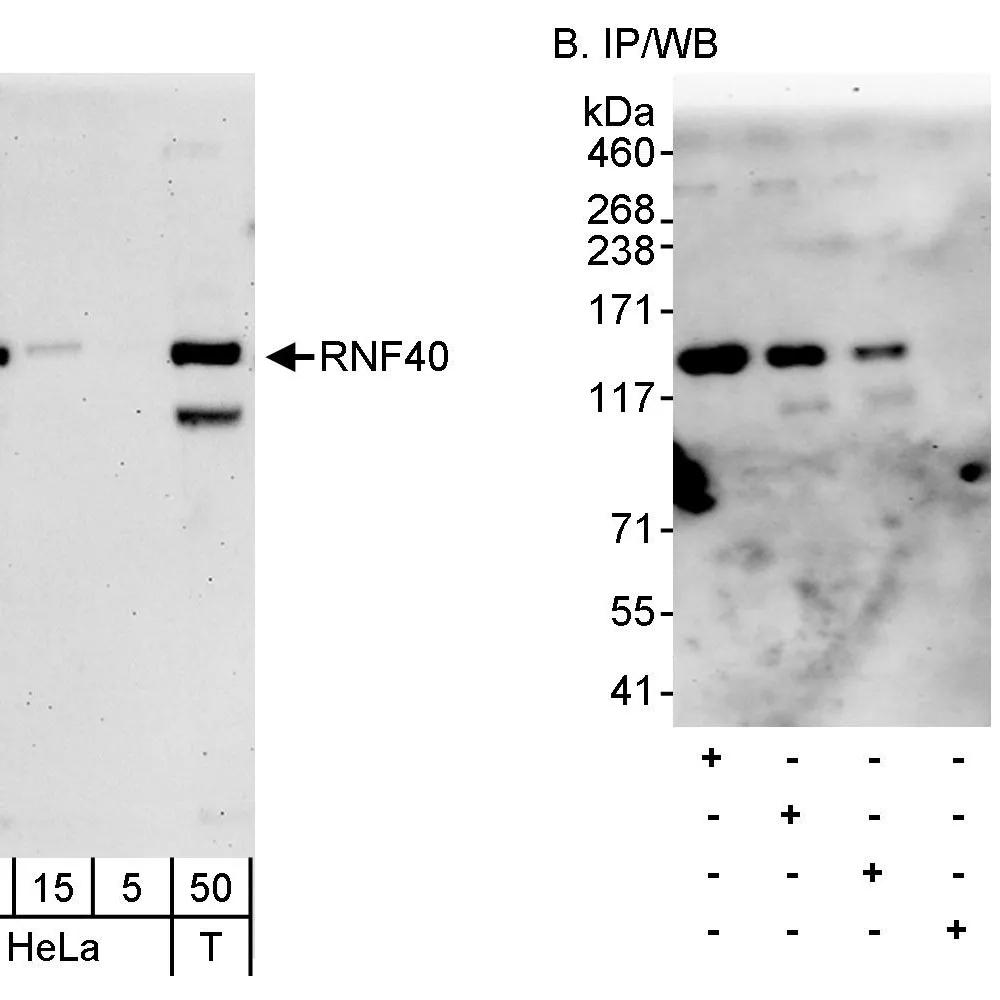 Rabbit anti-RNF40 Antibody, Affinity Purified