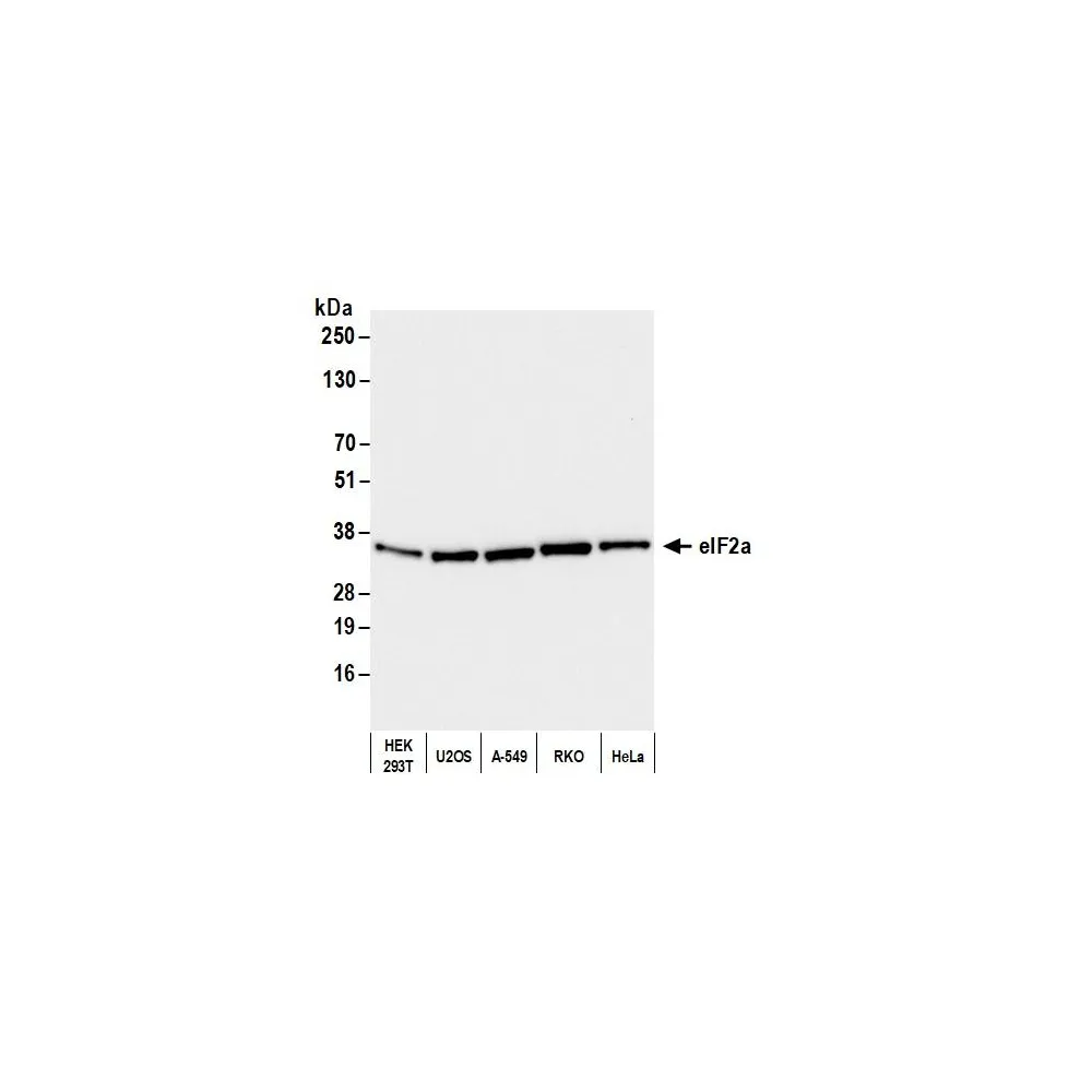 Rabbit anti-eIF2alpha/EIF2S1 Antibody, Affinity Purified