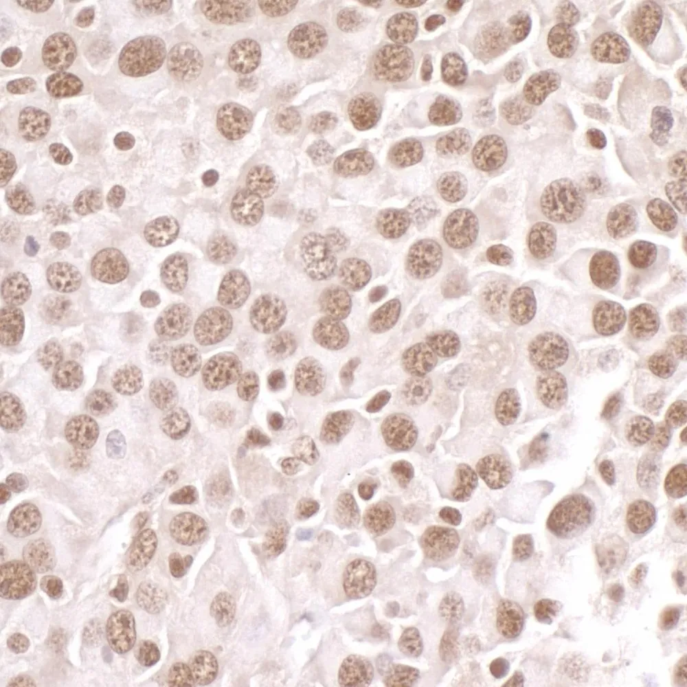 Rabbit anti-PRMT1 Antibody, Affinity Purified
