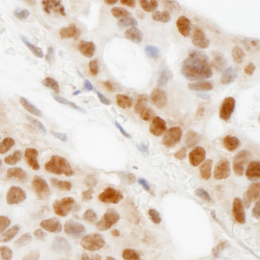 Rabbit anti-BAAT1 Antibody, Affinity Purified